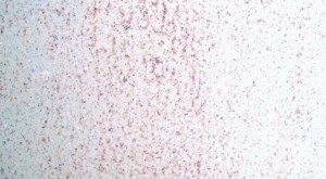 kollisi-plakidion-gupsosanida1.1